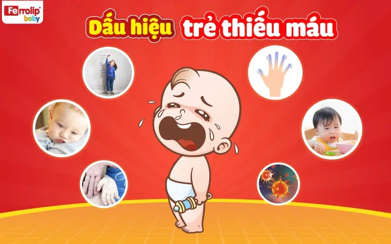 dấu hiệu trẻ thiếu máu bệnh lý