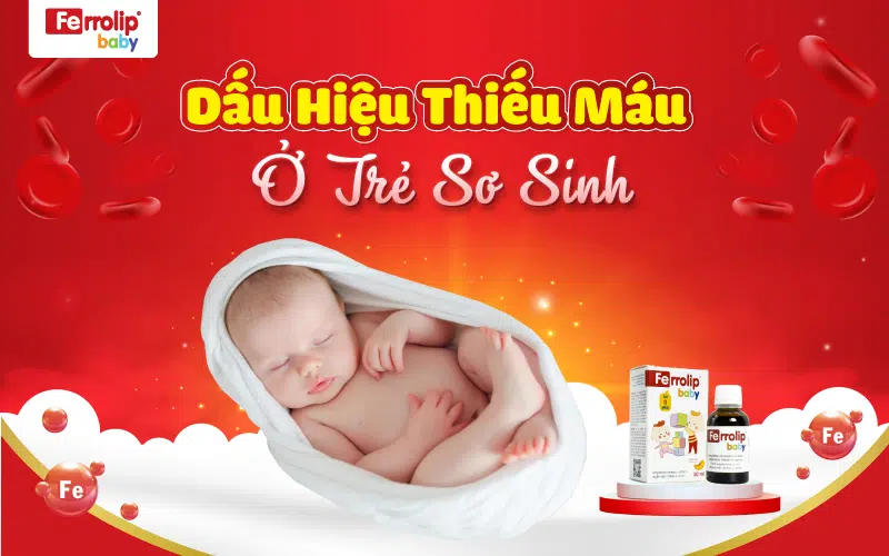 Dấu hiệu thiếu máu nặng ở trẻ em